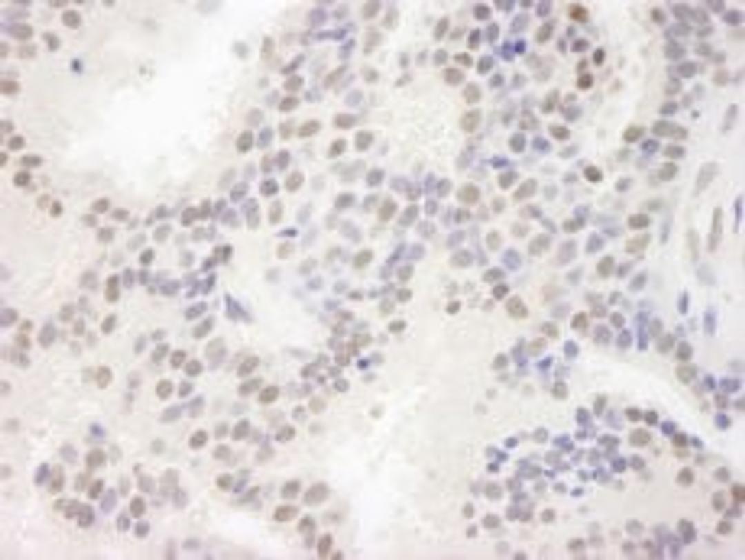 Detection of human MAML3 by immunohistochemistry.