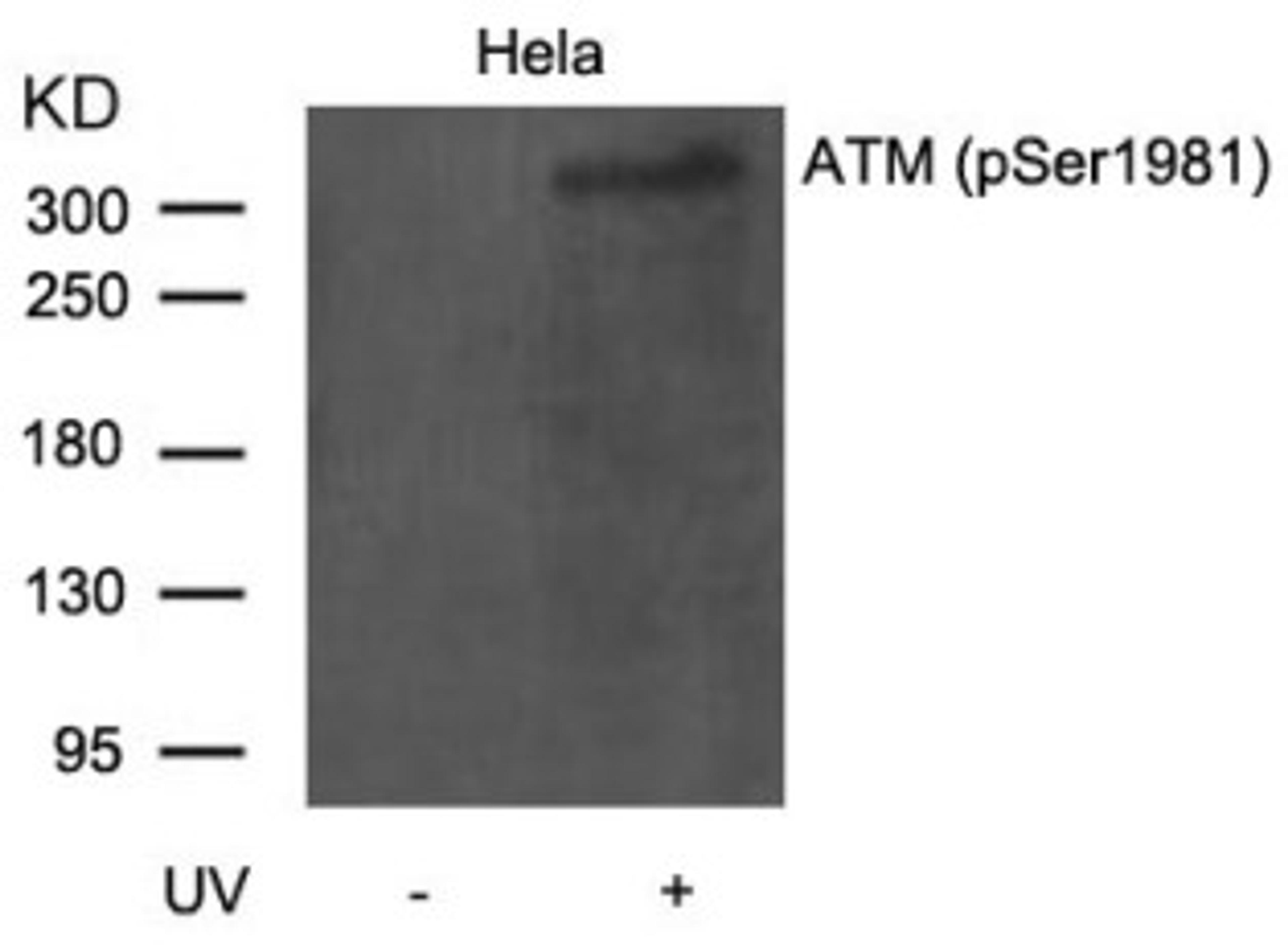 Western blot analysis of lysed extracts from HeLa cells untreated or treated with UV using ATM (Phospho-Ser1981).