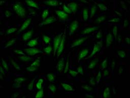 Immunofluorescence staining of Hela Cells with CSB-RA904931A0HU at 1:50, counter-stained with DAPI. The cells were fixed in 4% formaldehyde, permeated by 0.2% TritonX-100, and blocked in 10% normal Goat Serum. The cells were then incubated with the antibody overnight at 4℃. Nuclear DNA was labeled in blue with DAPI. The secondary antibody was FITC-conjugated AffiniPure Goat Anti-Rabbit IgG (H+L).
