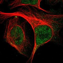 Immunocytochemistry/Immunofluorescence: Gi24/VISTA/B7-H5 Antibody [NBP1-88967] - Staining of human cell line U-2 OS shows positivity in nuclei but not nucleoli.