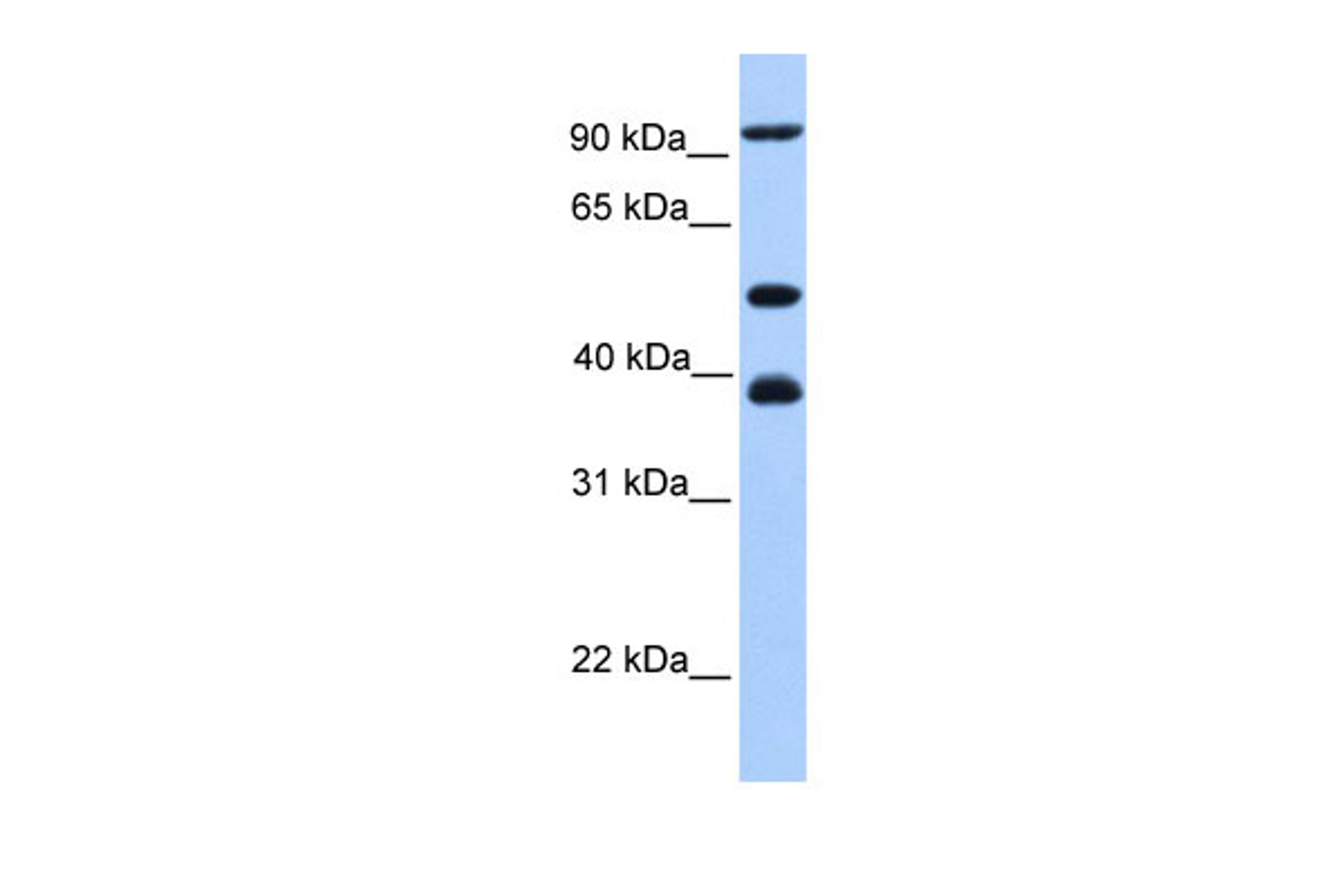 Antibody used in WB on Human 721_B at 0.2-1 ug/ml.