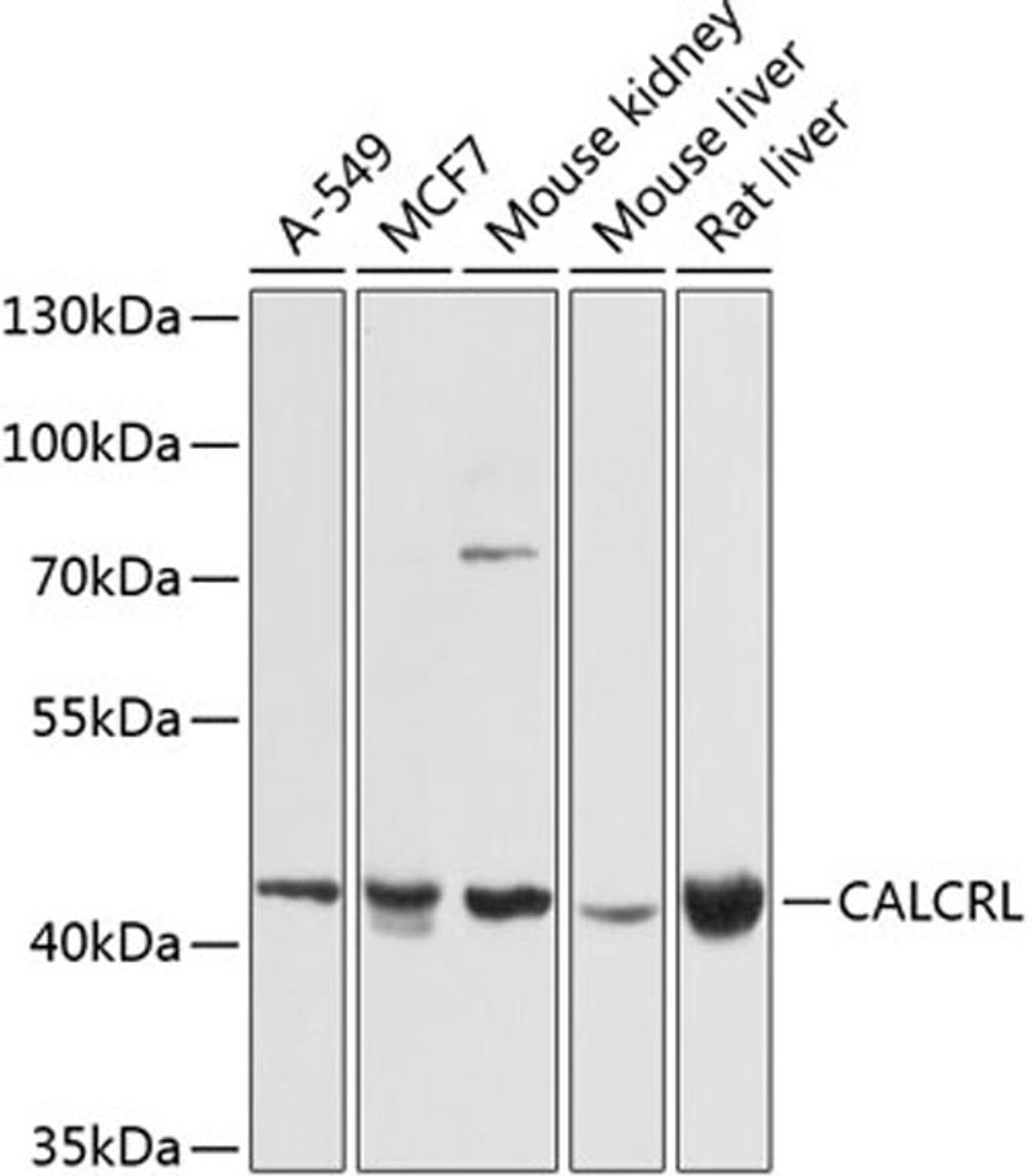 Western blot - CALCRL antibody (A8533)