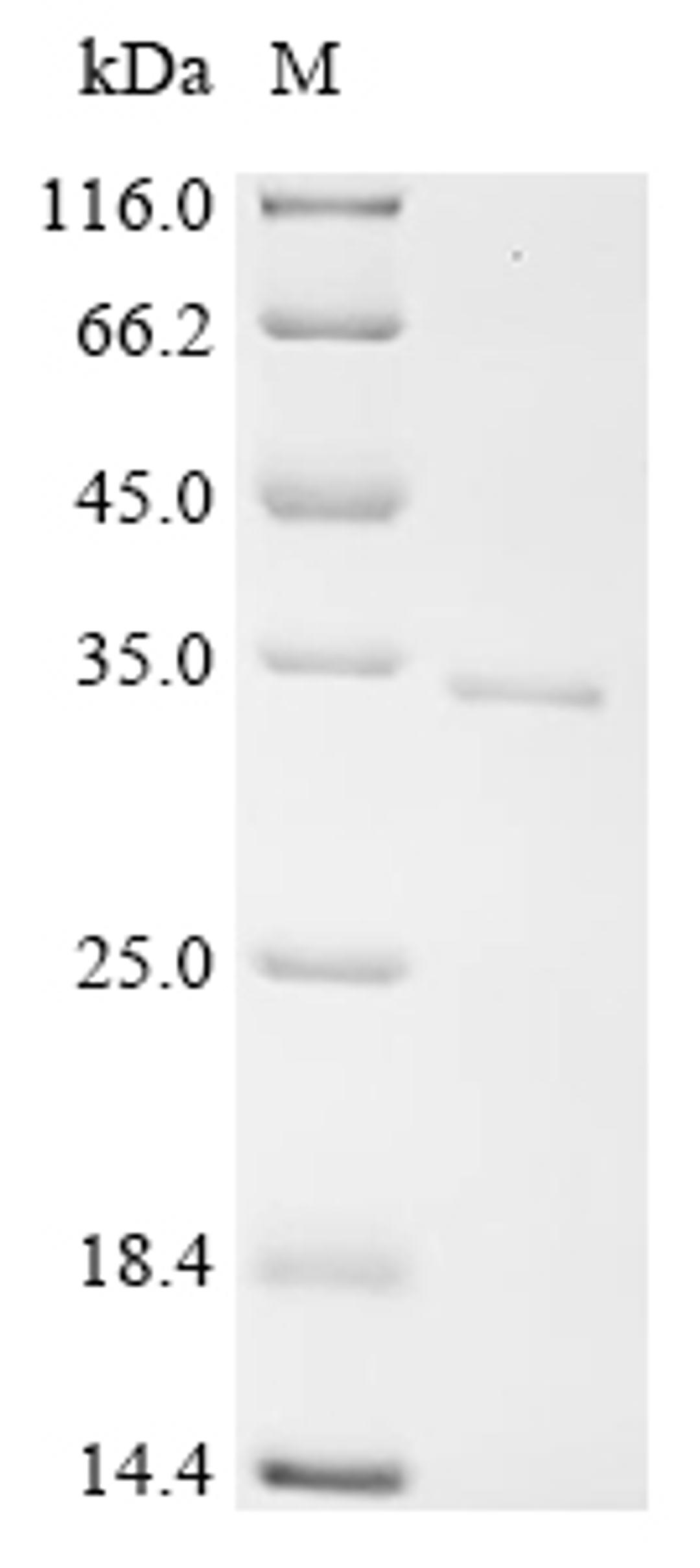 (Tris-Glycine gel) Discontinuous SDS-PAGE (reduced) with 5% enrichment gel and 15% separation gel.