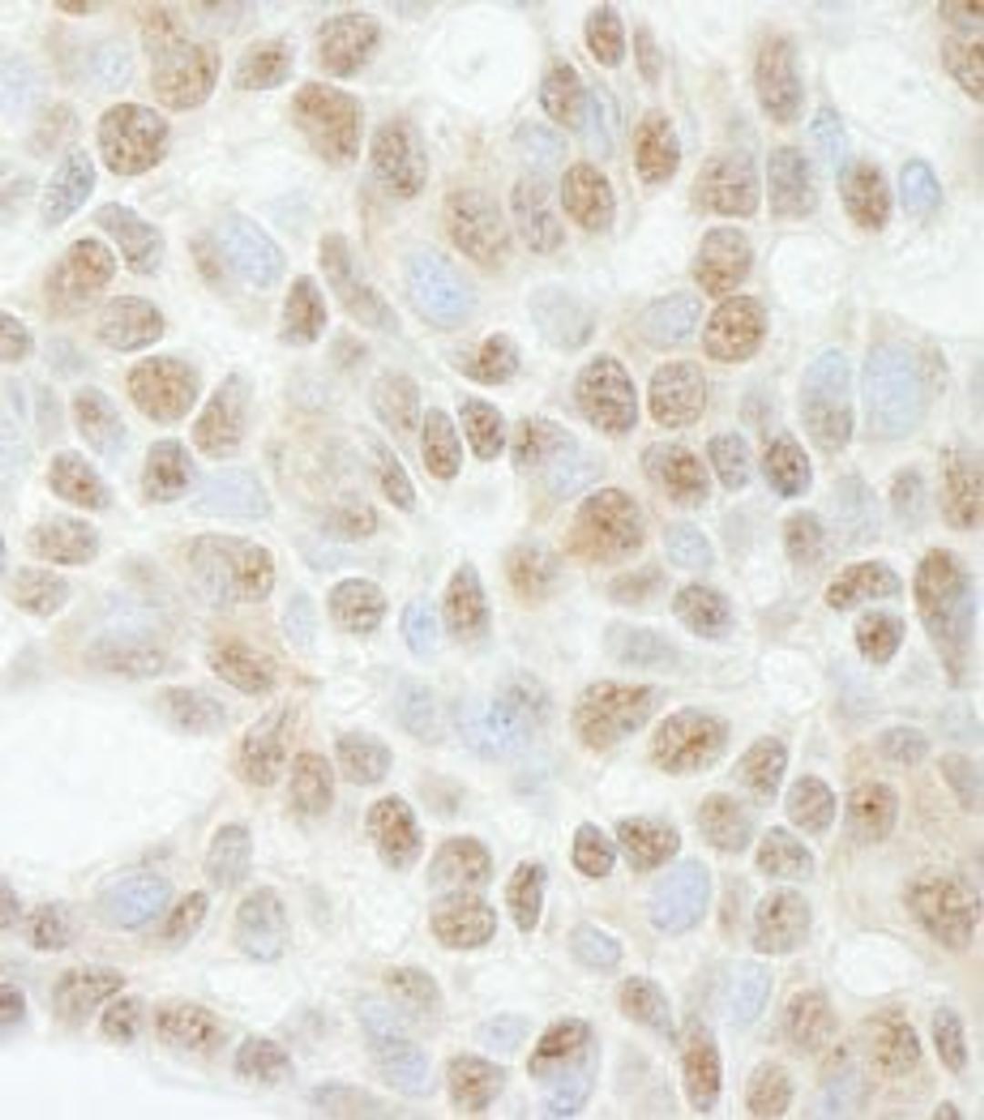 Detection of human ADNP by immunohistochemistry.