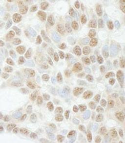 Detection of human ADNP by immunohistochemistry.