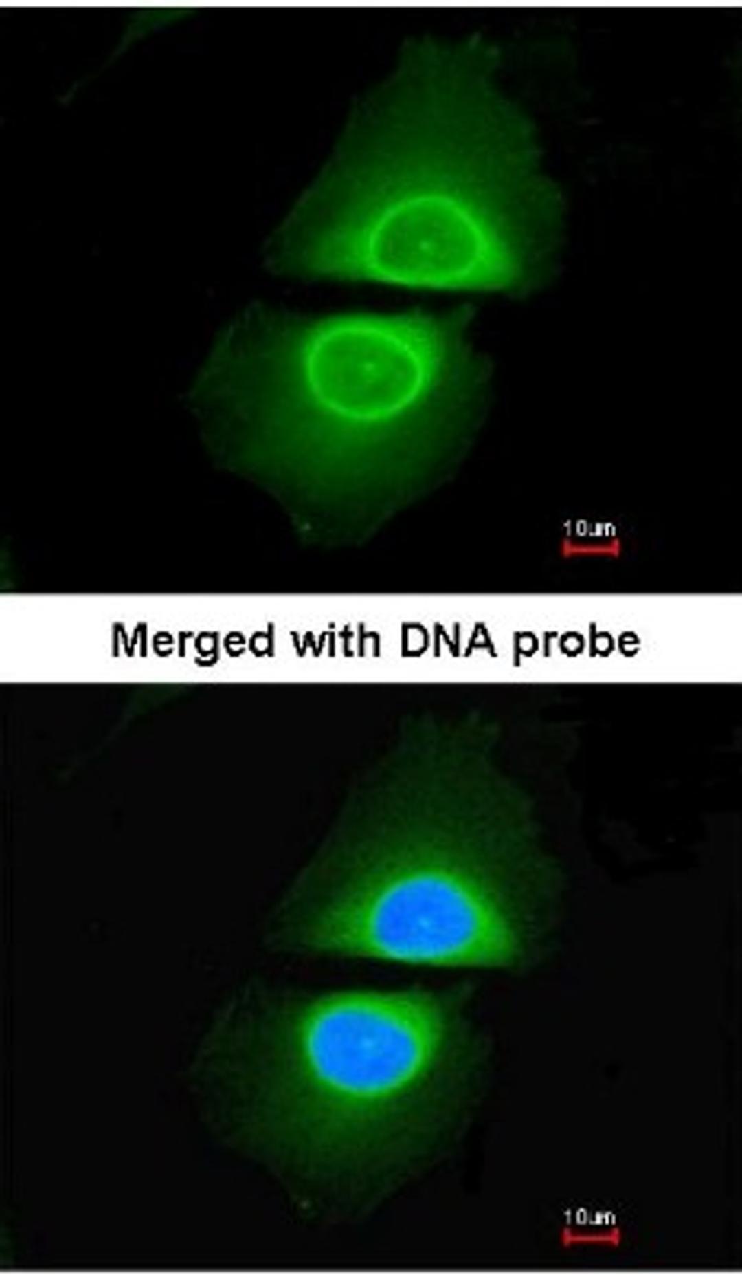 Immunocytochemistry/Immunofluorescence: Cytochrome P450 4A Antibody [NBP1-31427] - Analysis of HeLa, using NBP1-31427 at 1:200 dilution.