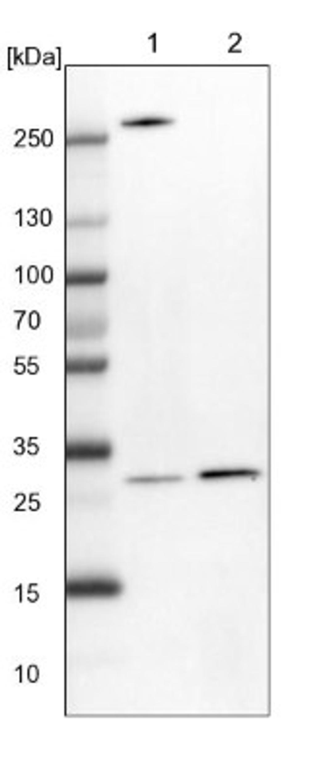 Western Blot: Shwachman Bodian-Diamond syndrome Antibody [NBP1-85646] - Lane 1: NIH-3T3 cell lysate (Mouse embryonic fibroblast cells)<br/>Lane 2: NBT-II cell lysate (Rat Wistar bladder tumour cells)