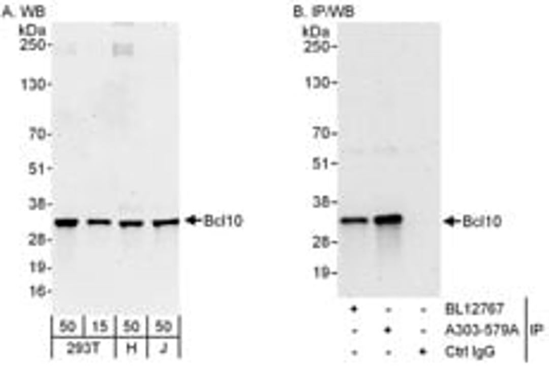 Detection of human Bcl10 by western blot and immunoprecipitation.