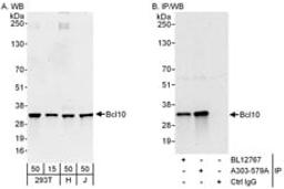 Detection of human Bcl10 by western blot and immunoprecipitation.