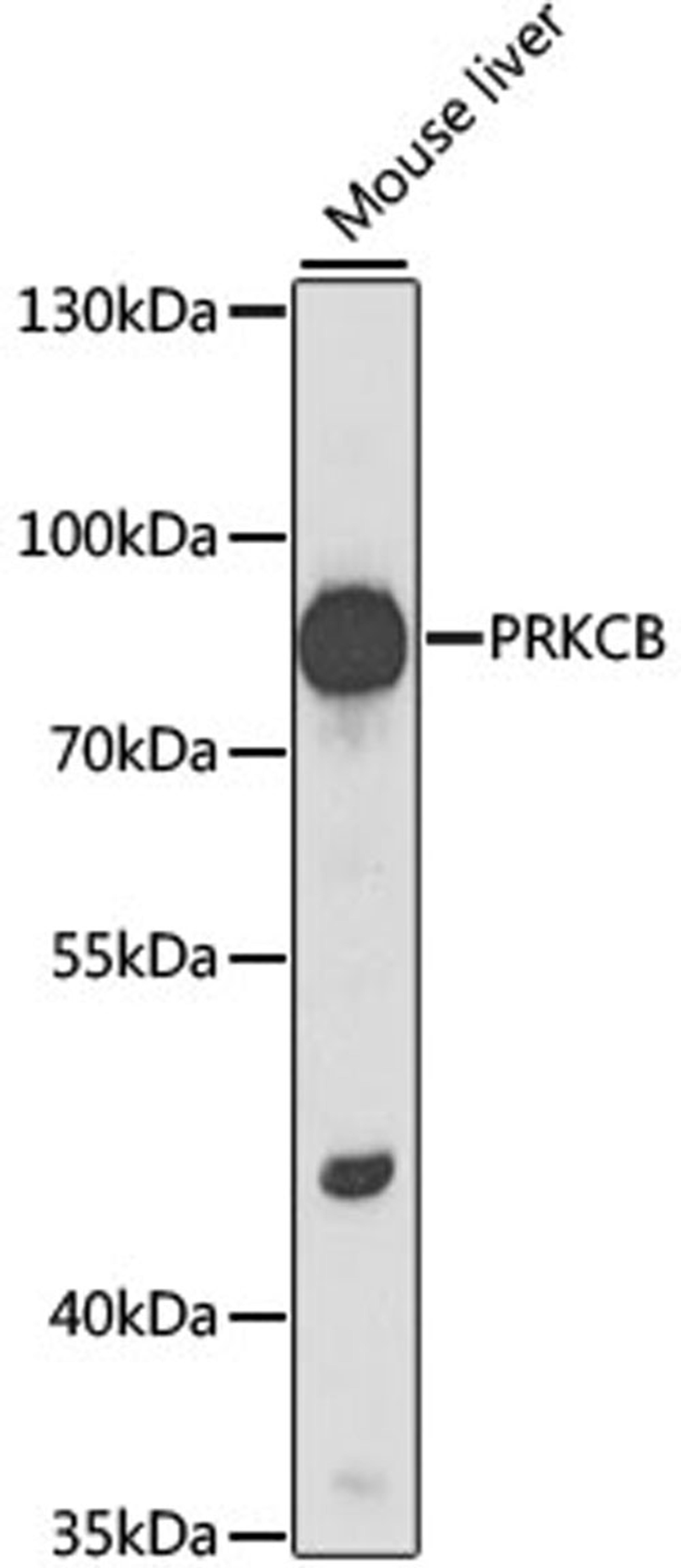 Western blot - PRKCB antibody (A13628)