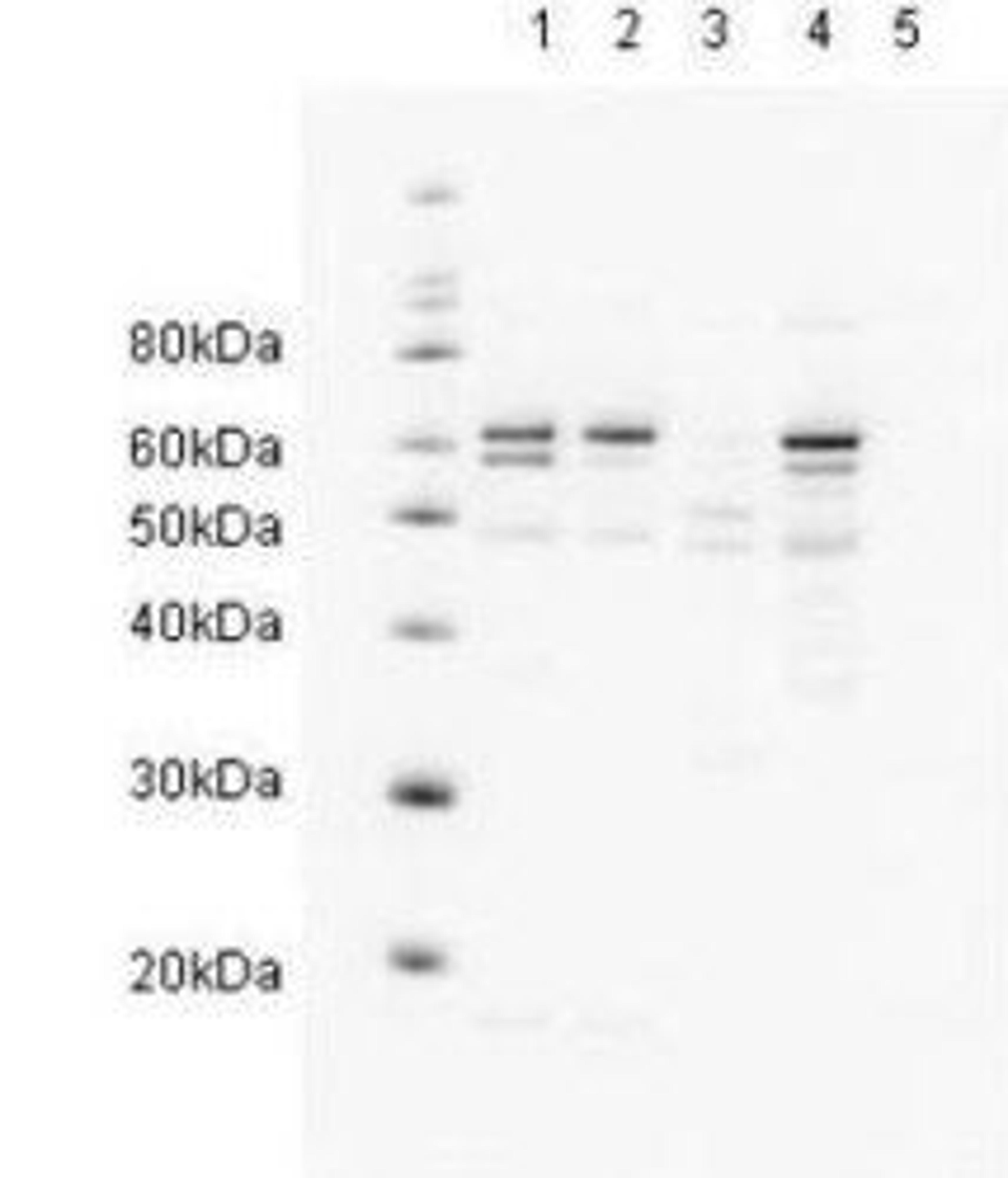 Western blot analysis of HeLa nuclear extract (lane 1) and HeLa (lane 2), A431 (lane 3), Jurkat (lane 4) and 293 whole cell lysates (lane 5) using HR23A antibody