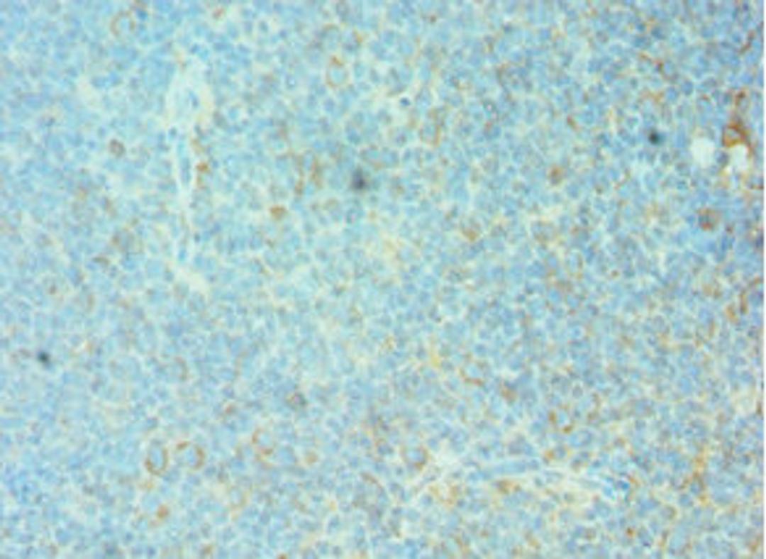 Immunohistochemistry of paraffin-embedded human tonsil tissue using CSB-PA008792DSR1HU at dilution of 1:100