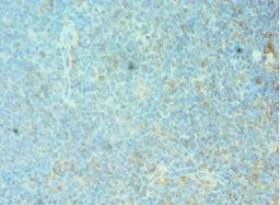 Immunohistochemistry of paraffin-embedded human tonsil tissue using CSB-PA008792DSR1HU at dilution of 1:100