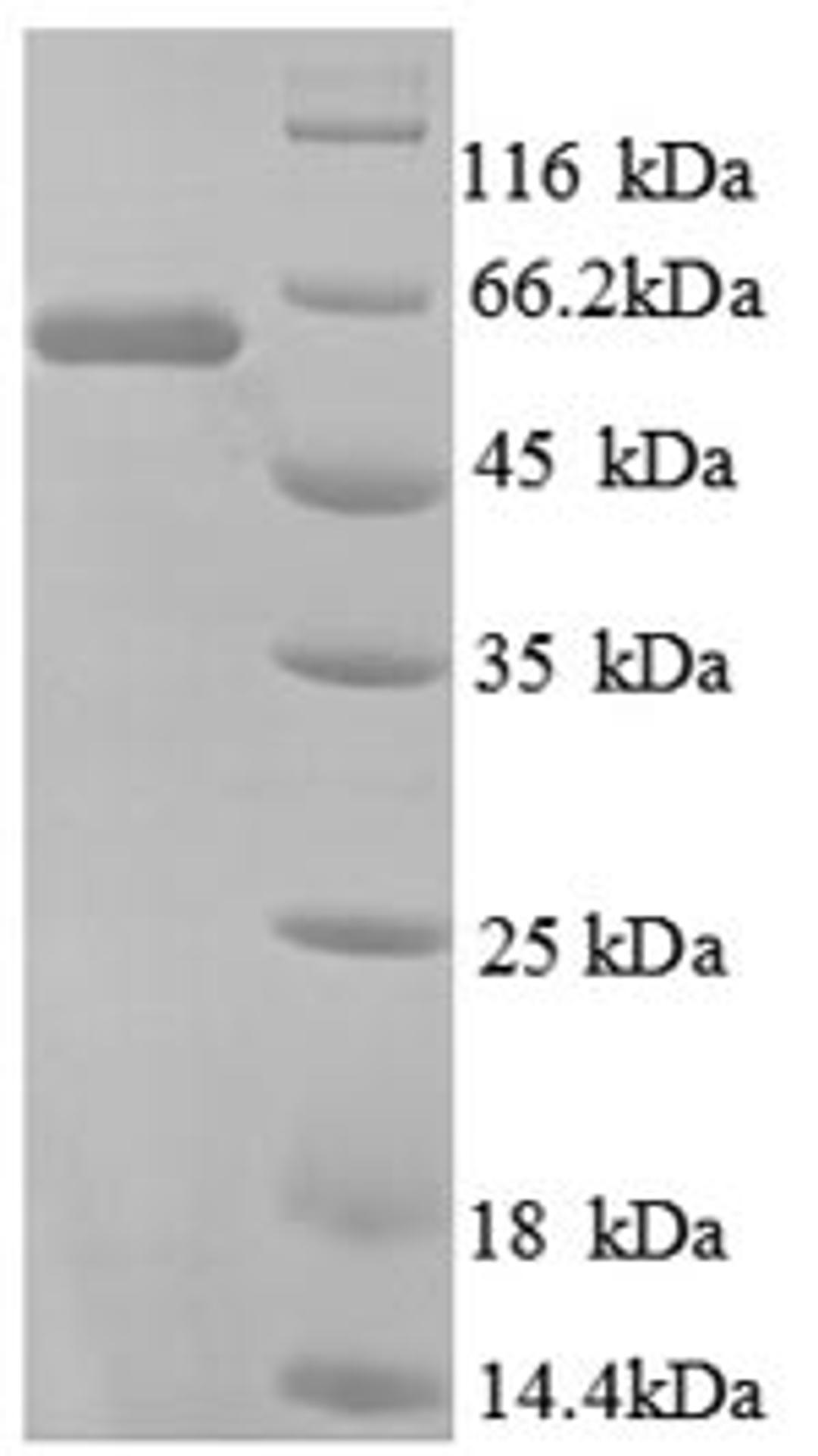 (Tris-Glycine gel) Discontinuous SDS-PAGE (reduced) with 5% enrichment gel and 15% separation gel.