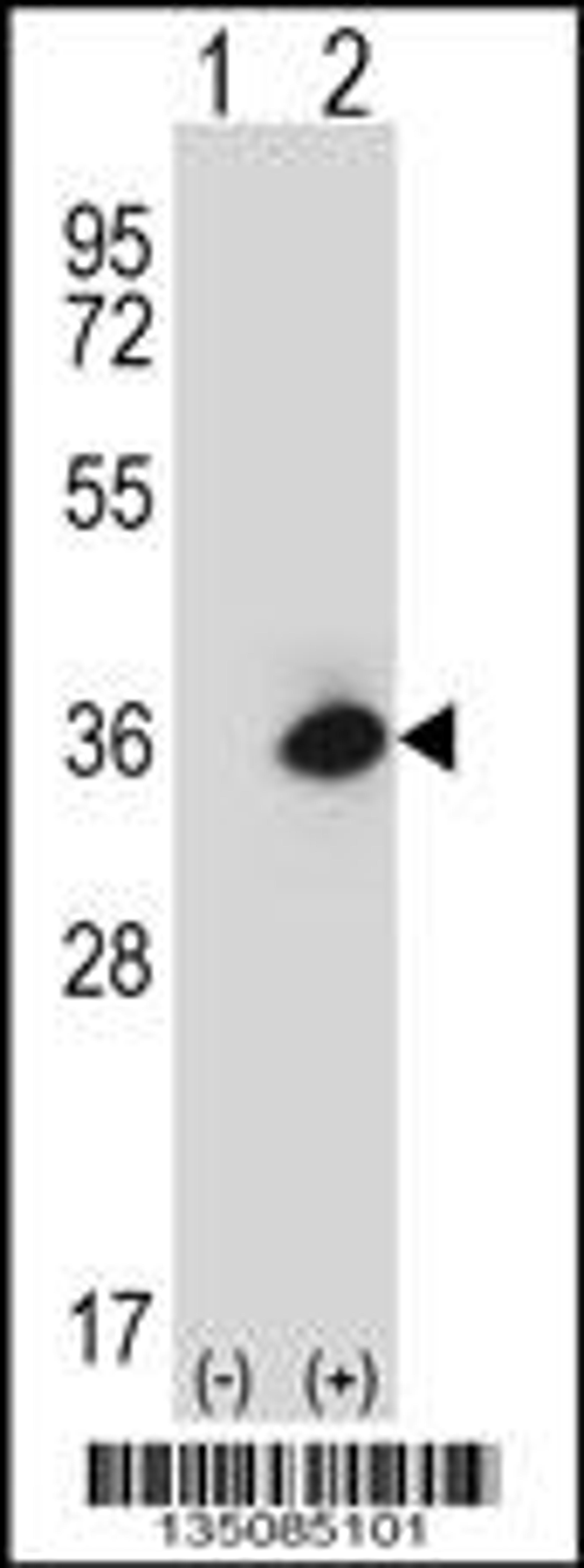 Western blot analysis of Rage using rabbit polyclonal Mouse Rage Antibody using 293 cell lysates (2 ug/lane) either nontransfected (Lane 1) or transiently transfected (Lane 2) with the Rage gene.