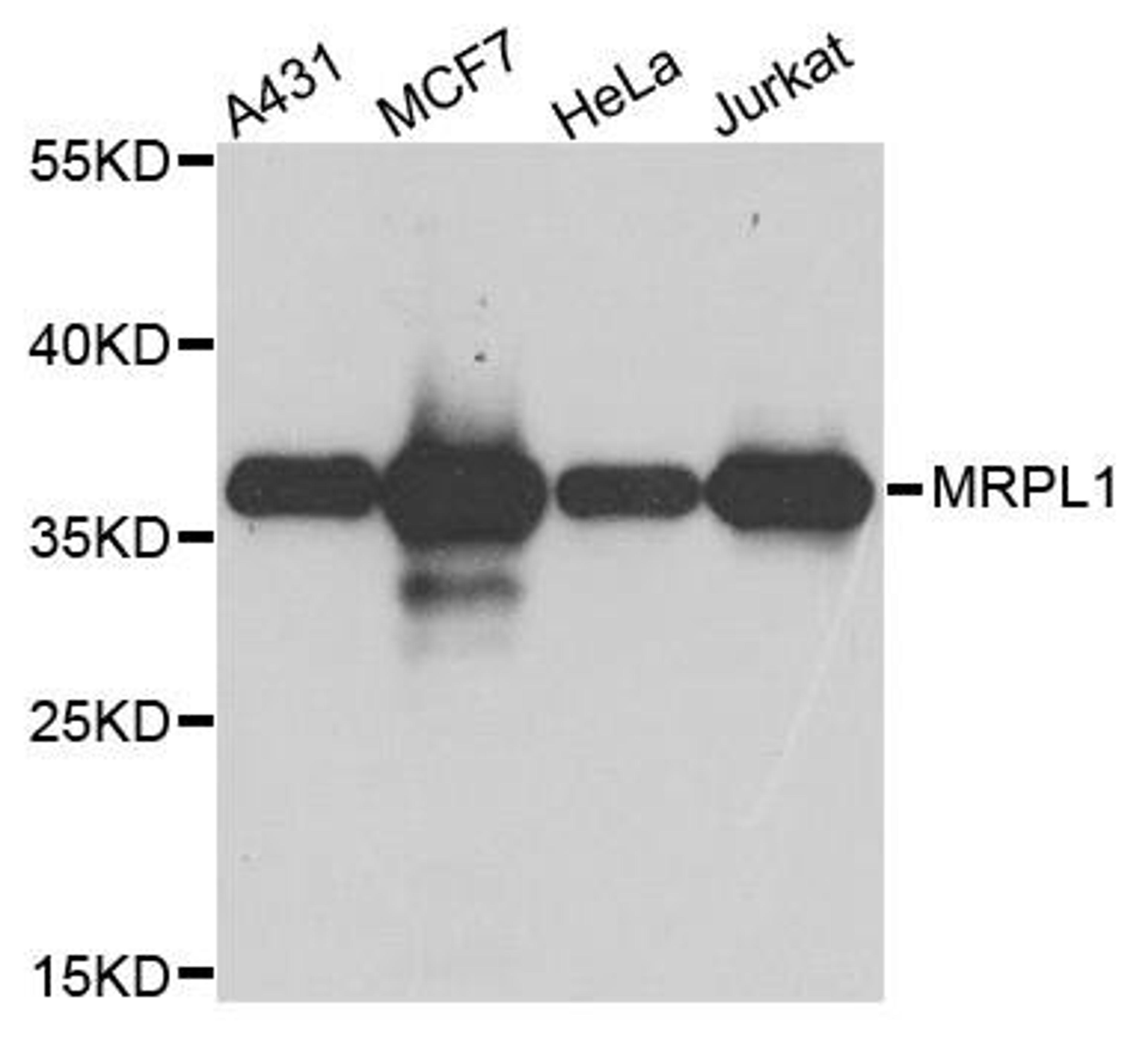 Western blot analysis of extract of various cells using MRPL1 antibody