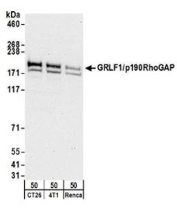 Detection of mouse GRLF1/p190RhoGAP by western blot.