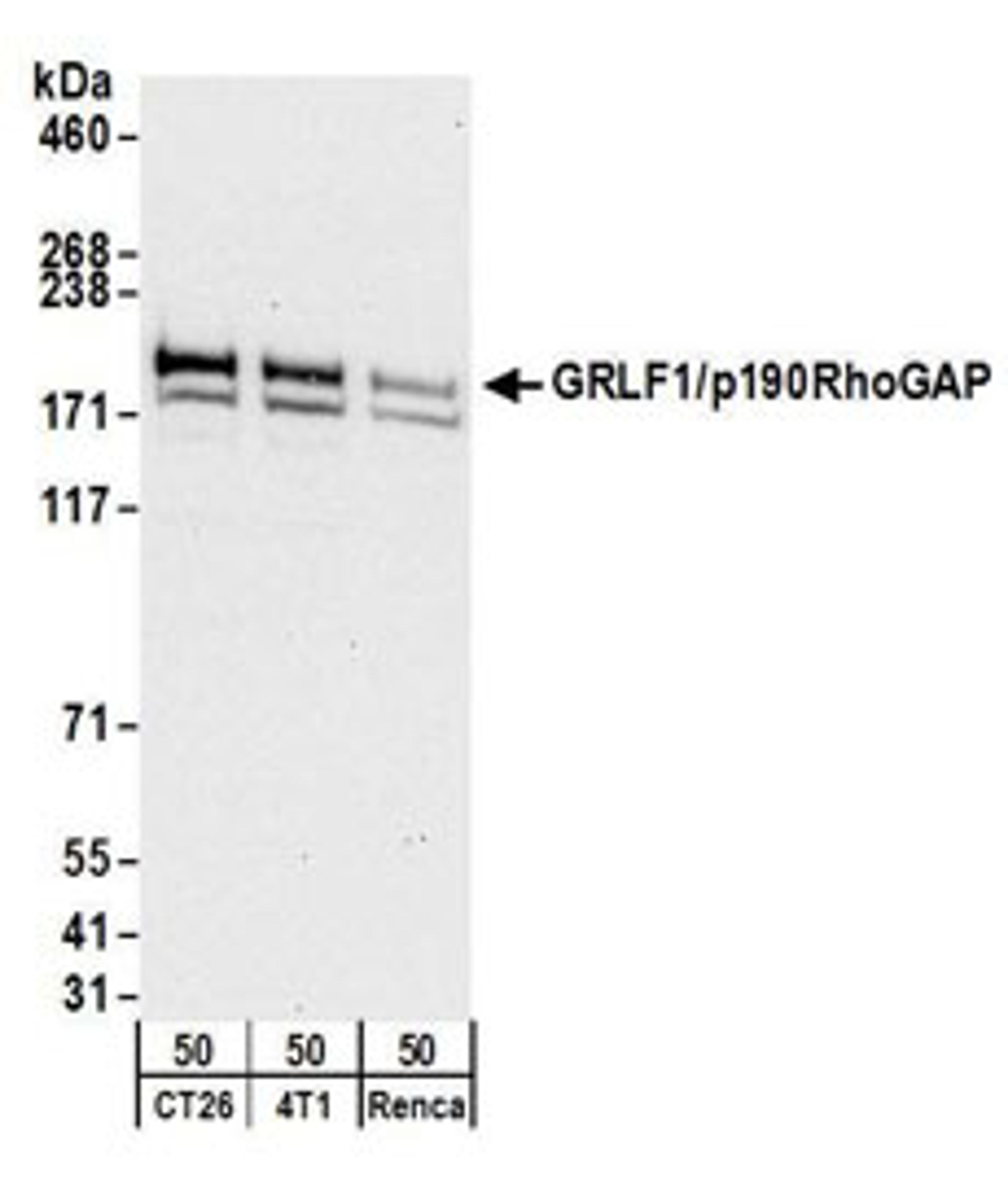 Detection of mouse GRLF1/p190RhoGAP by western blot.