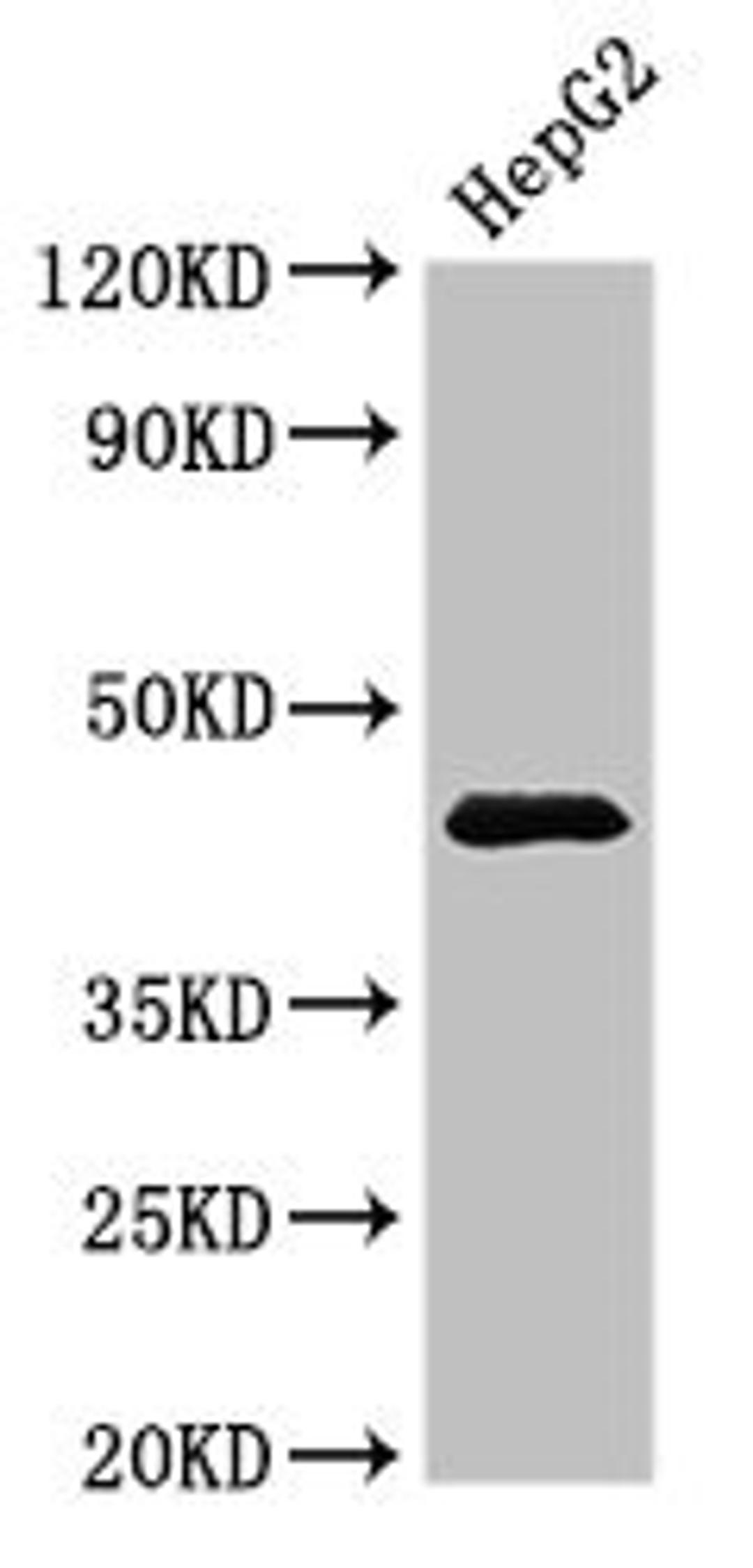 Western Blot. Positive WB detected in: HepG2 whole cell lysate. All lanes: PSMC5 antibody at 3.5ug/ml. Secondary. Goat polyclonal to rabbit IgG at 1/50000 dilution. Predicted band size: 46, 45 kDa. Observed band size: 46 kDa. 
