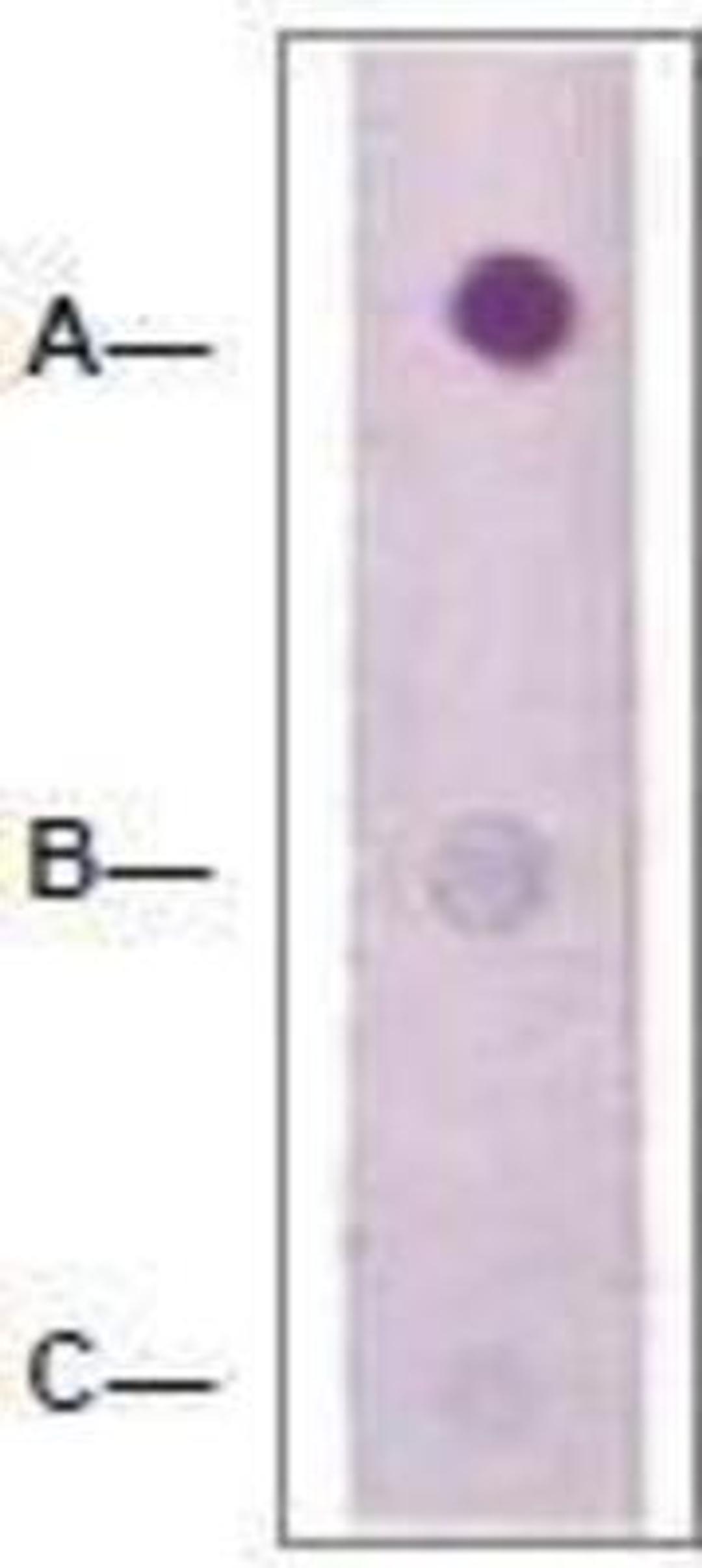 Dot Blot: RhoA Antibody [NBP1-74684] - 1 mg peptide was blot onto NC membrane (ARho (pS188); B-Rho (Nonphospho); C: Nonrelated Phosphopeptide) was blotted by Rabbit anti-Rho (pS188) at a 1:2000 dilution.