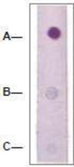 Dot Blot: RhoA Antibody [NBP1-74684] - 1 mg peptide was blot onto NC membrane (ARho (pS188); B-Rho (Nonphospho); C: Nonrelated Phosphopeptide) was blotted by Rabbit anti-Rho (pS188) at a 1:2000 dilution.