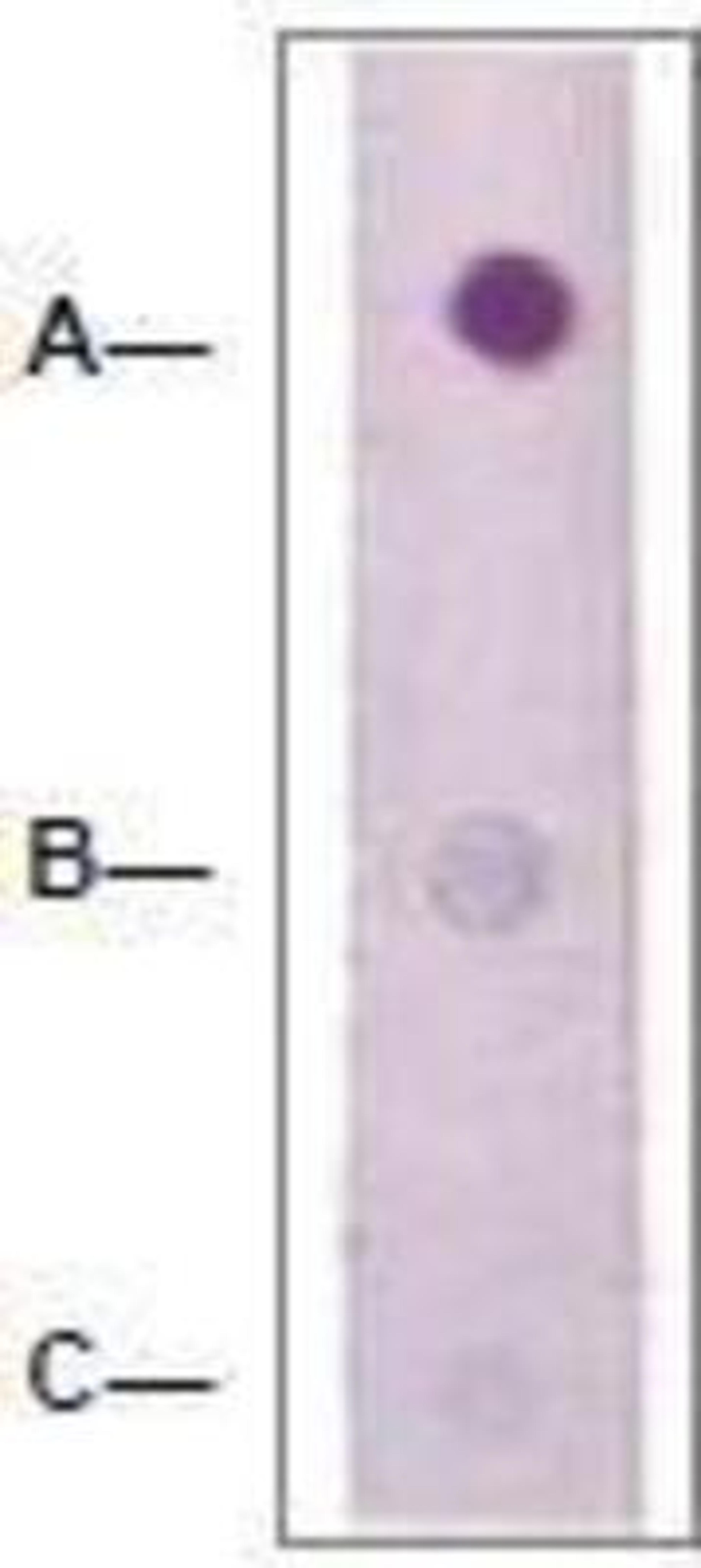 Dot Blot: RhoA Antibody [NBP1-74684] - 1 mg peptide was blot onto NC membrane (ARho (pS188); B-Rho (Nonphospho); C: Nonrelated Phosphopeptide) was blotted by Rabbit anti-Rho (pS188) at a 1:2000 dilution.