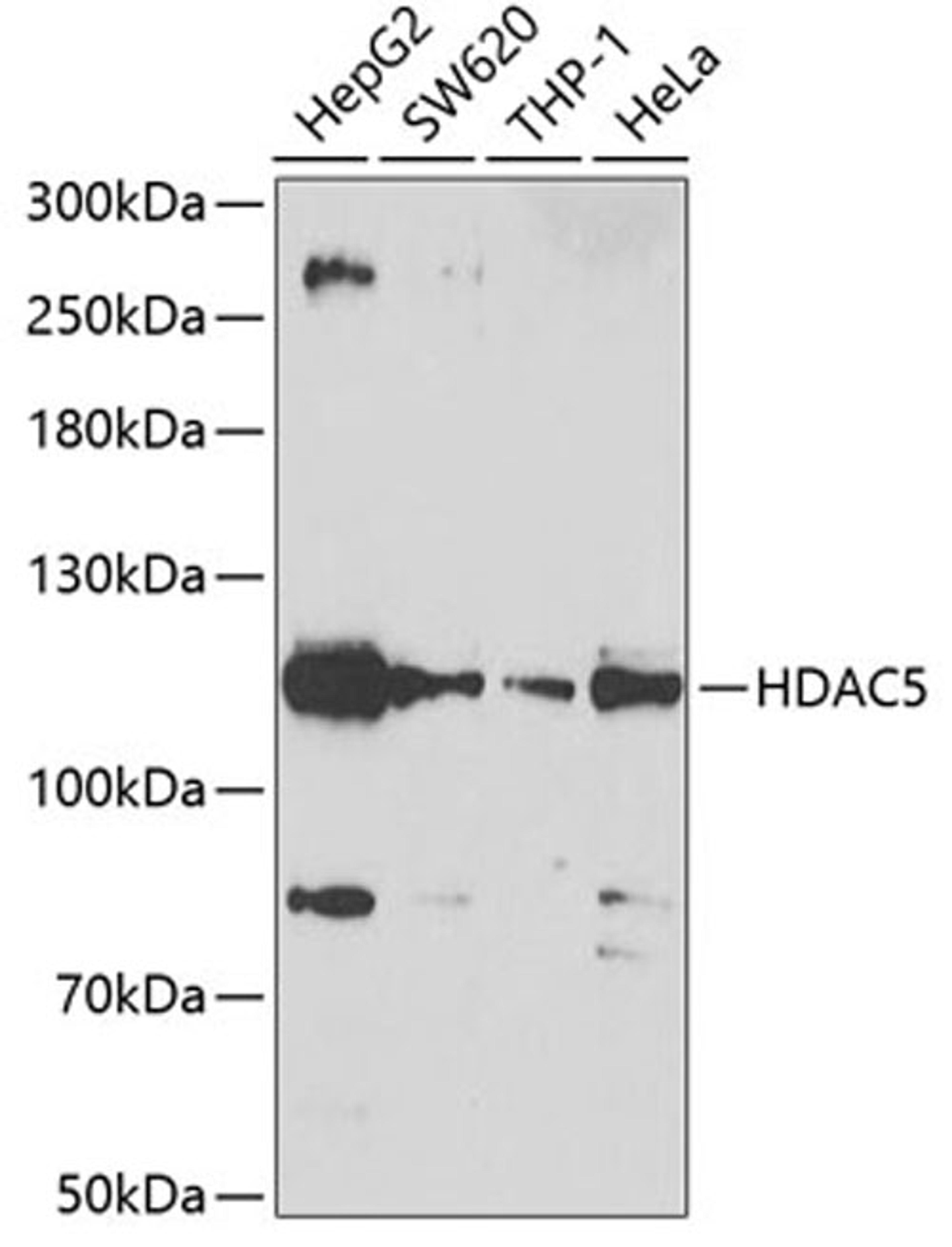 Western blot - HDAC5 antibody (A7189)