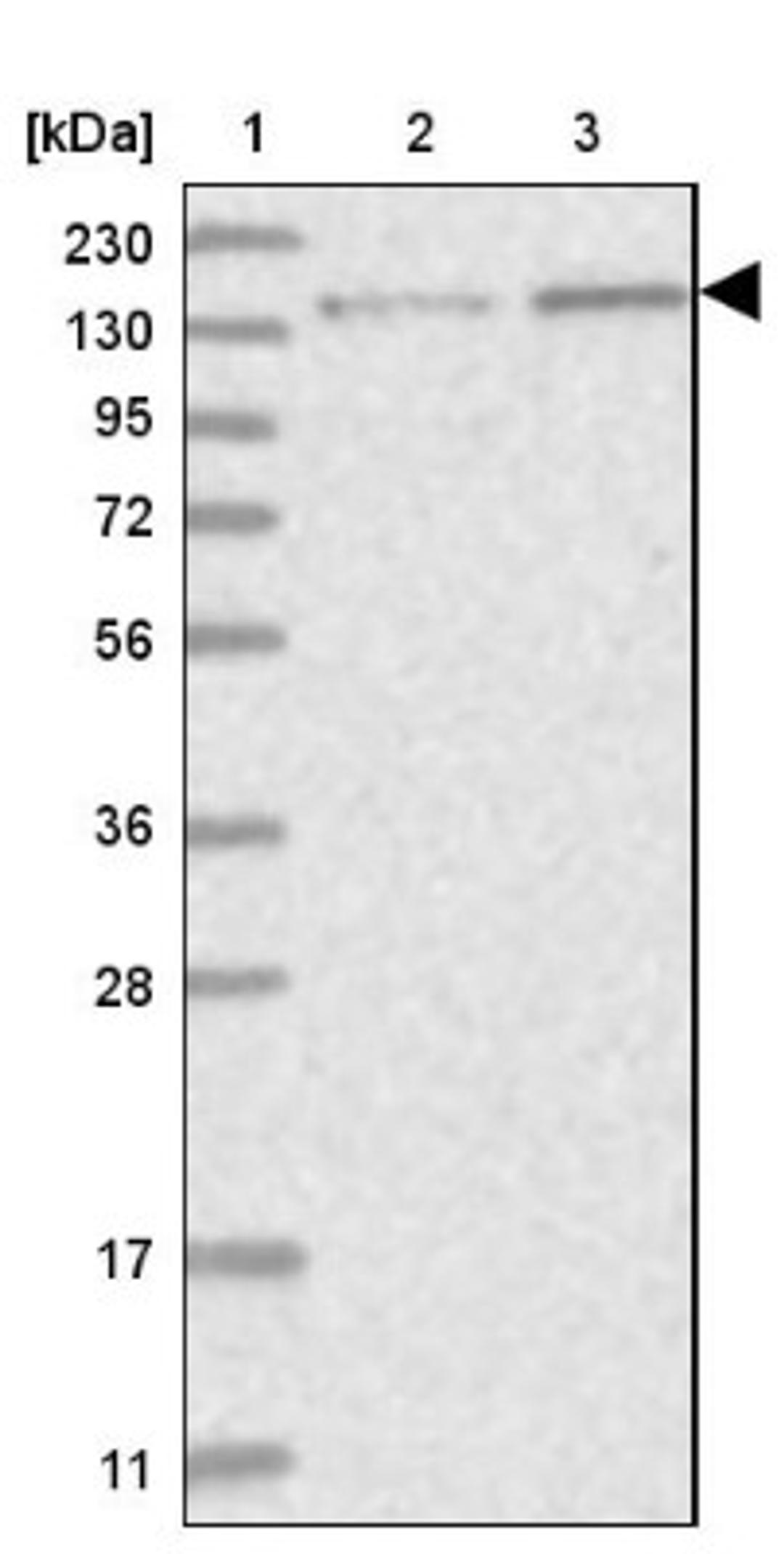 Western Blot: PPP2R3A Antibody [NBP1-87233] - Lane 1: Marker [kDa] 230, 130, 95, 72, 56, 36, 28, 17, 11<br/>Lane 2: Human cell line RT-4<br/>Lane 3: Human cell line U-251MG sp