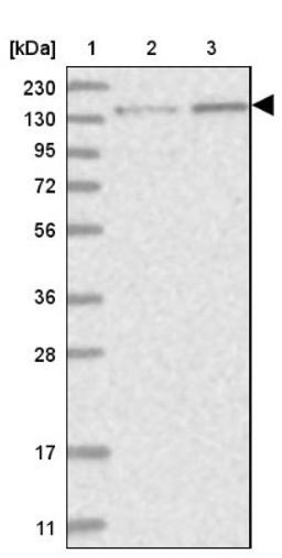 Western Blot: PPP2R3A Antibody [NBP1-87233] - Lane 1: Marker [kDa] 230, 130, 95, 72, 56, 36, 28, 17, 11<br/>Lane 2: Human cell line RT-4<br/>Lane 3: Human cell line U-251MG sp