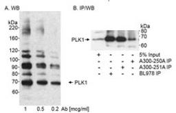 Detection of human PLK1 by western blot and immunoprecipitation.