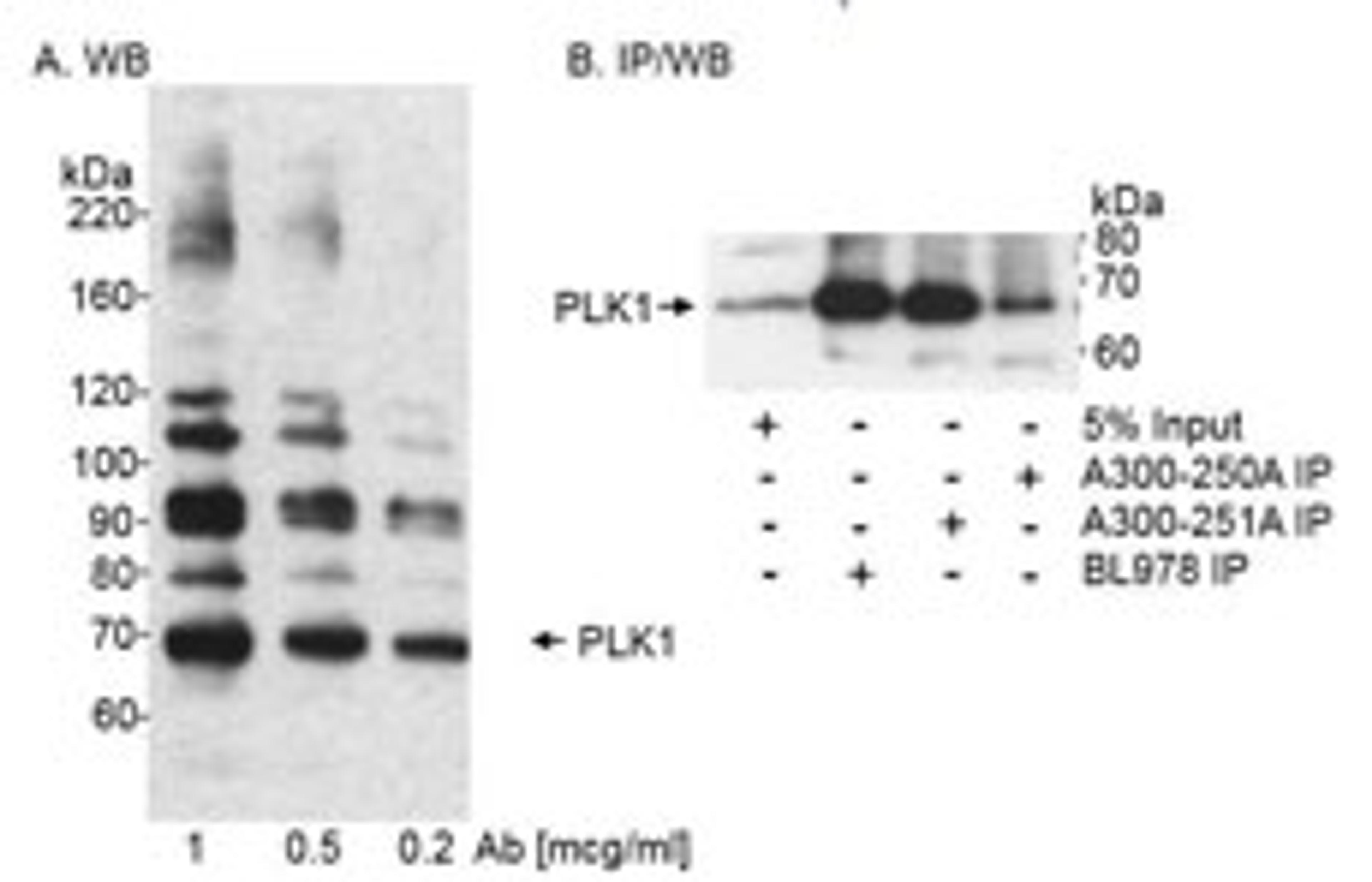 Detection of human PLK1 by western blot and immunoprecipitation.