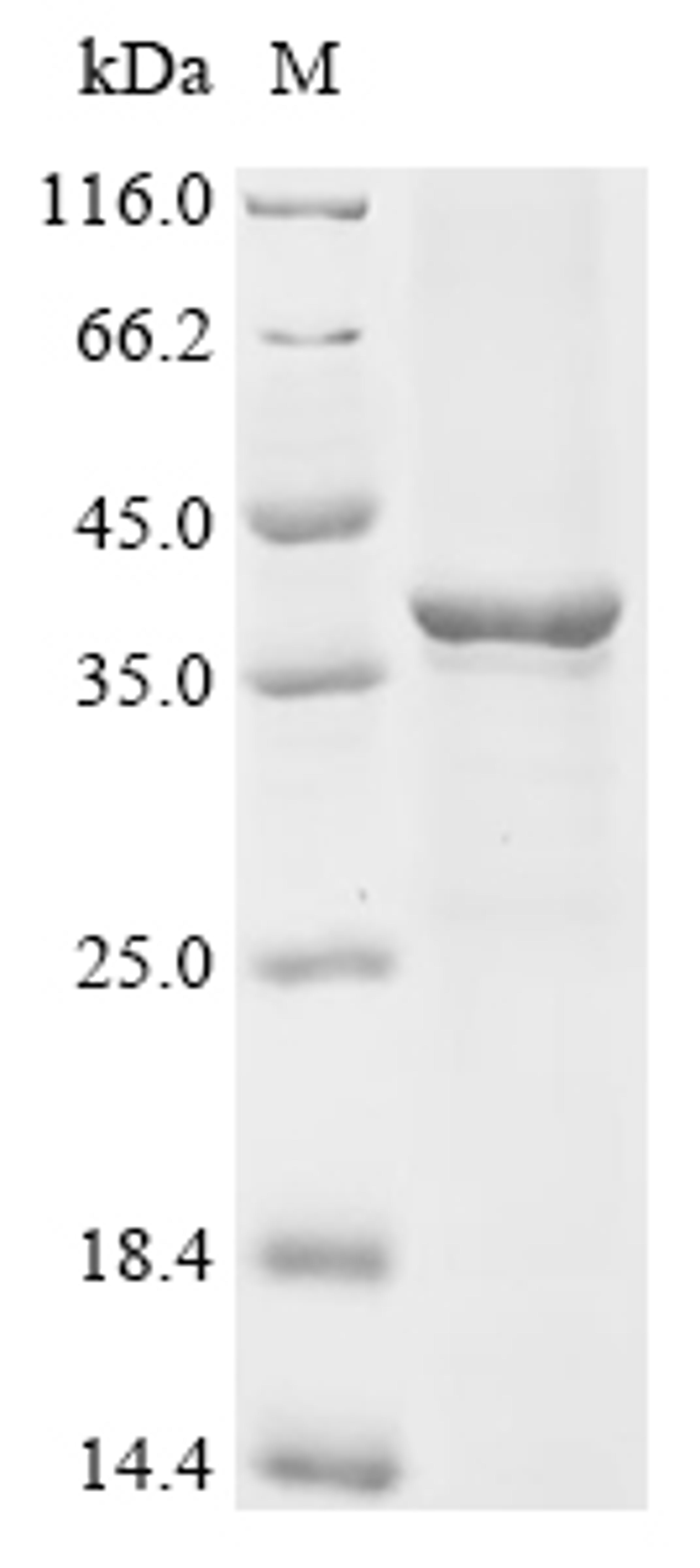 (Tris-Glycine gel) Discontinuous SDS-PAGE (reduced) with 5% enrichment gel and 15% separation gel.