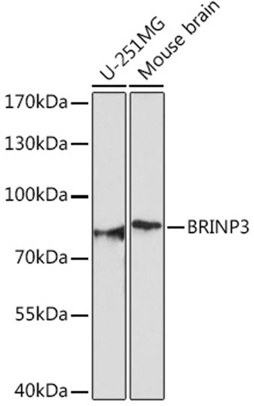 Western blot - BRINP3 Rabbit pAb (A18237)