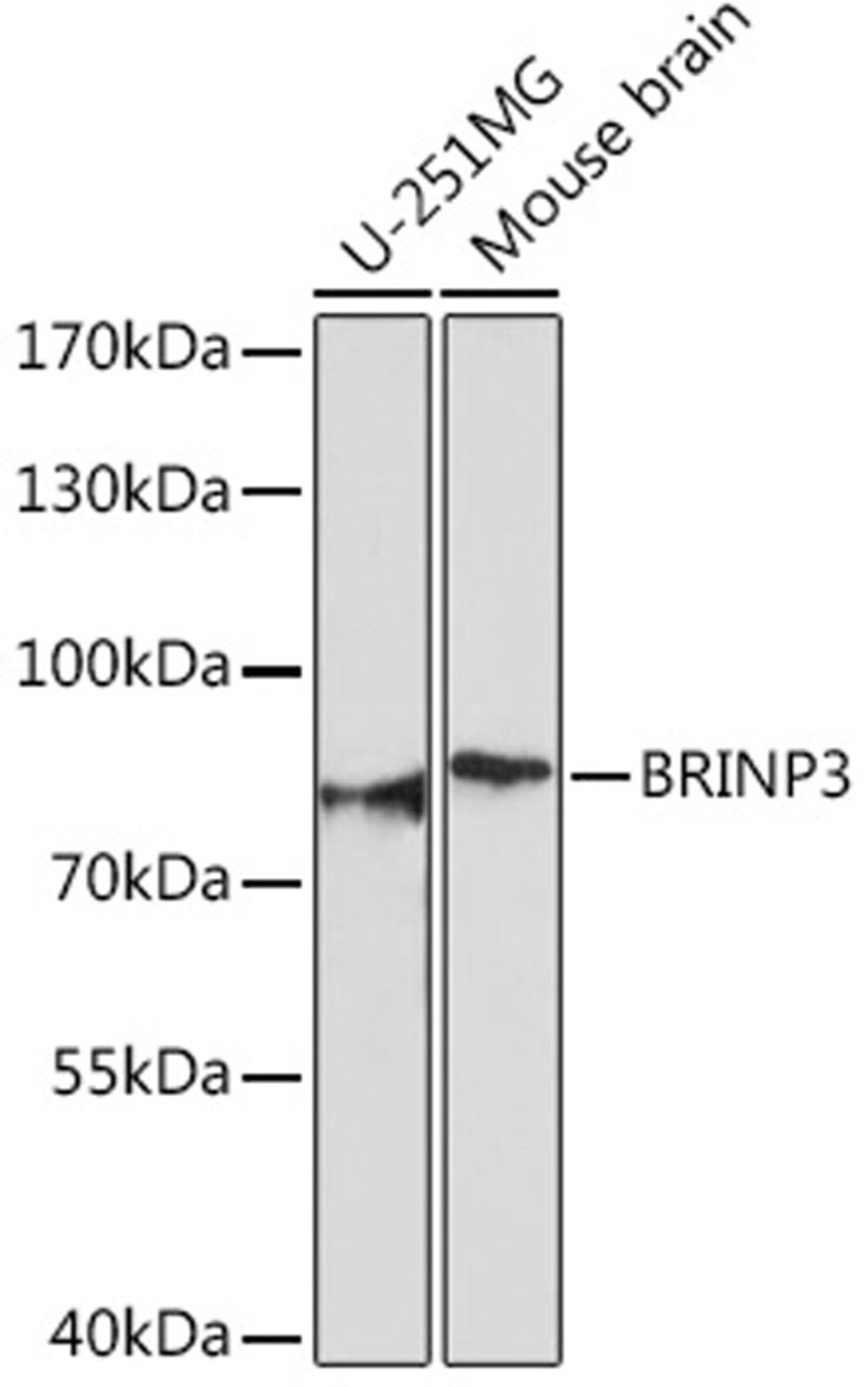 Western blot - BRINP3 Rabbit pAb (A18237)