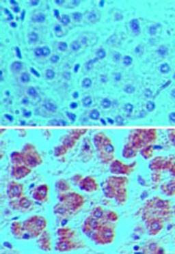 Immunohistochemistry-Paraffin: ATG7 Antibody [NBP2-24682] - Analysis of APG7L in formalin-fixed, paraffin-embedded human liver tissue using an isotype control (top) and this antibody (bottom) at 5 ug/ml.