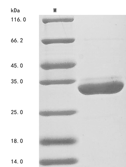 (Tris-Glycine gel) Discontinuous SDS-PAGE (reduced) with 5% enrichment gel and 15% separation gel.