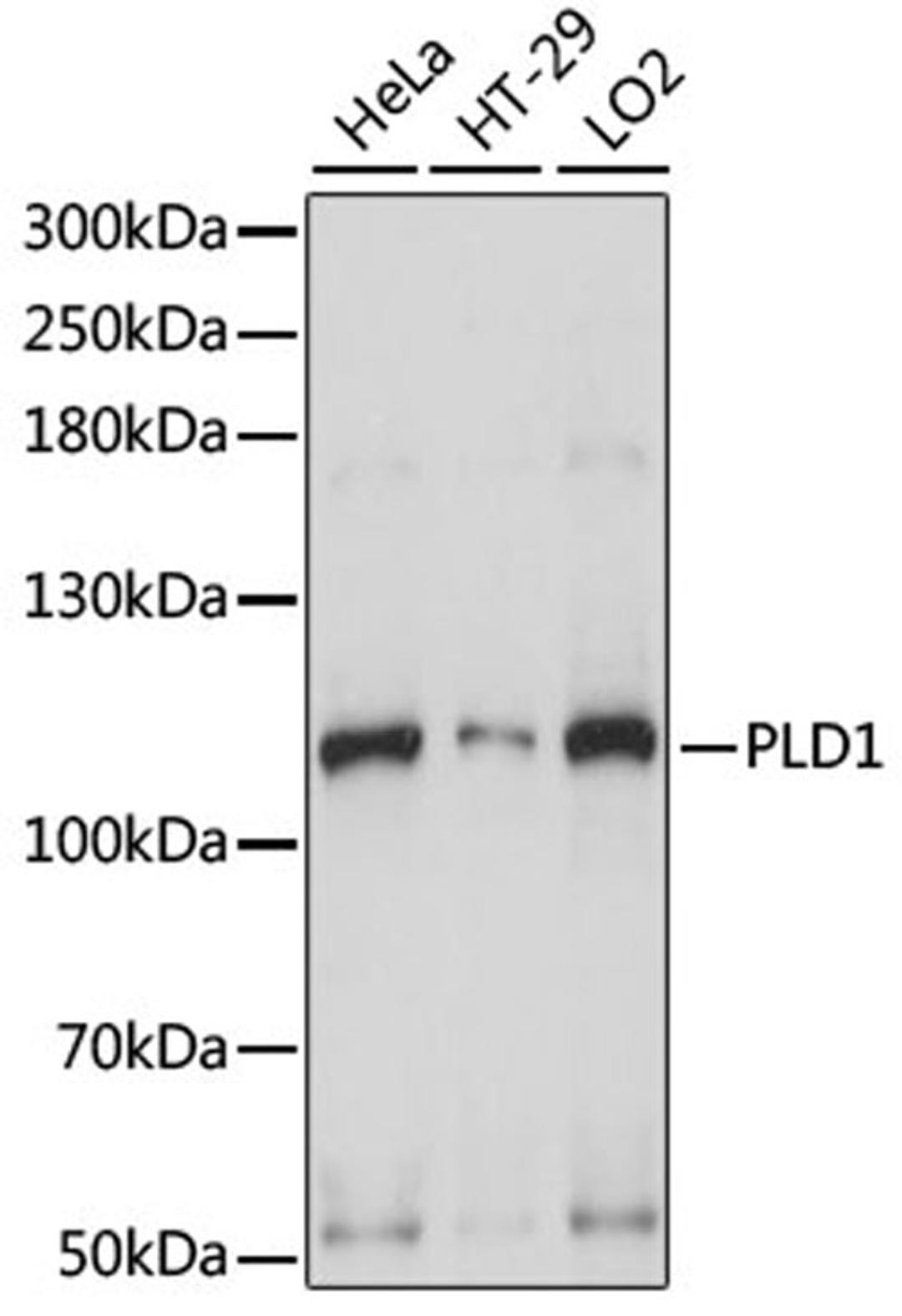 Western blot - PLD1 antibody (A15081)