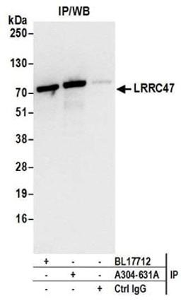 Detection of human LRRC47 by western blot of immunoprecipitates.