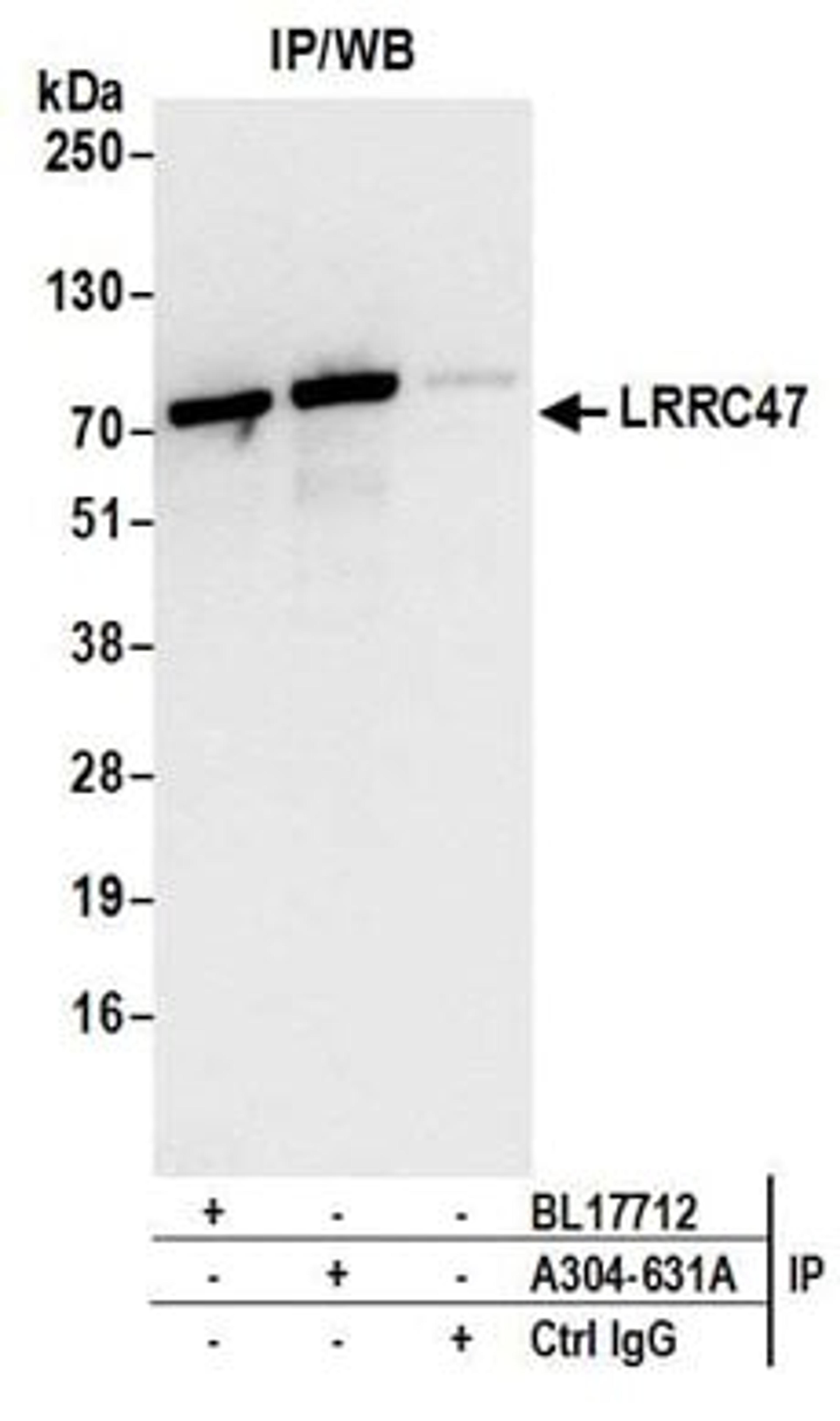 Detection of human LRRC47 by western blot of immunoprecipitates.