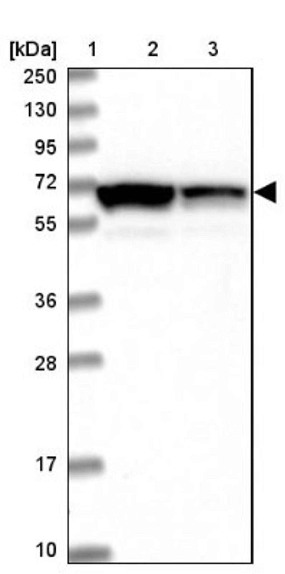 Immunohistochemistry: LRRC63 Antibody [NBP1-90670] - Lane 1: Marker [kDa] 250, 130, 95, 72, 55, 36, 28, 17, 10<br/>Lane 2: Human cell line RT-4<br/>Lane 3: Human cell line U-251MG sp