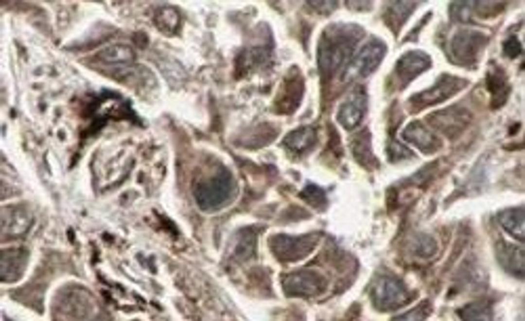 Immunohistochemical staining of human liver tissue using RFFL antibody