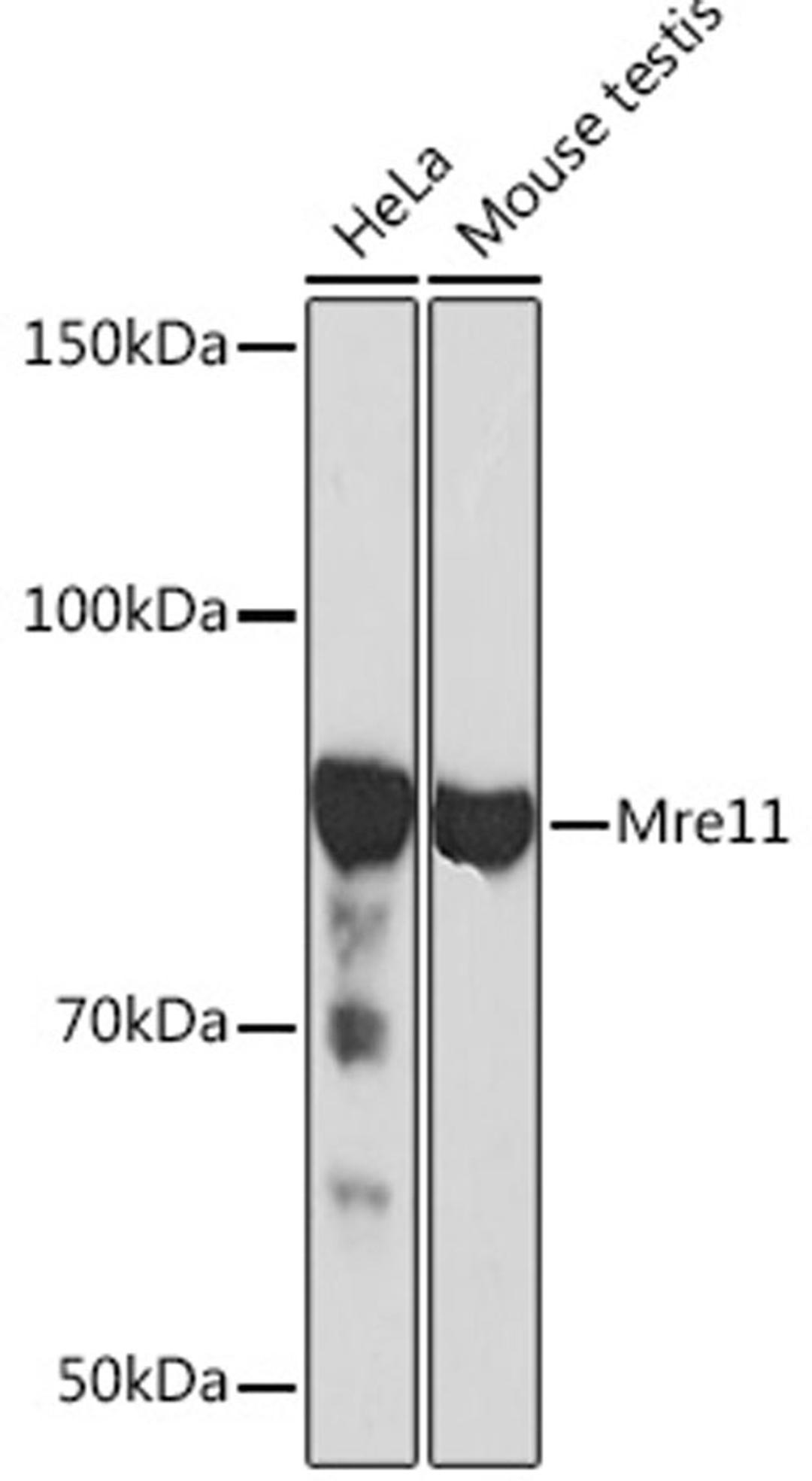 Western blot - Mre11 Rabbit mAb (A4222)