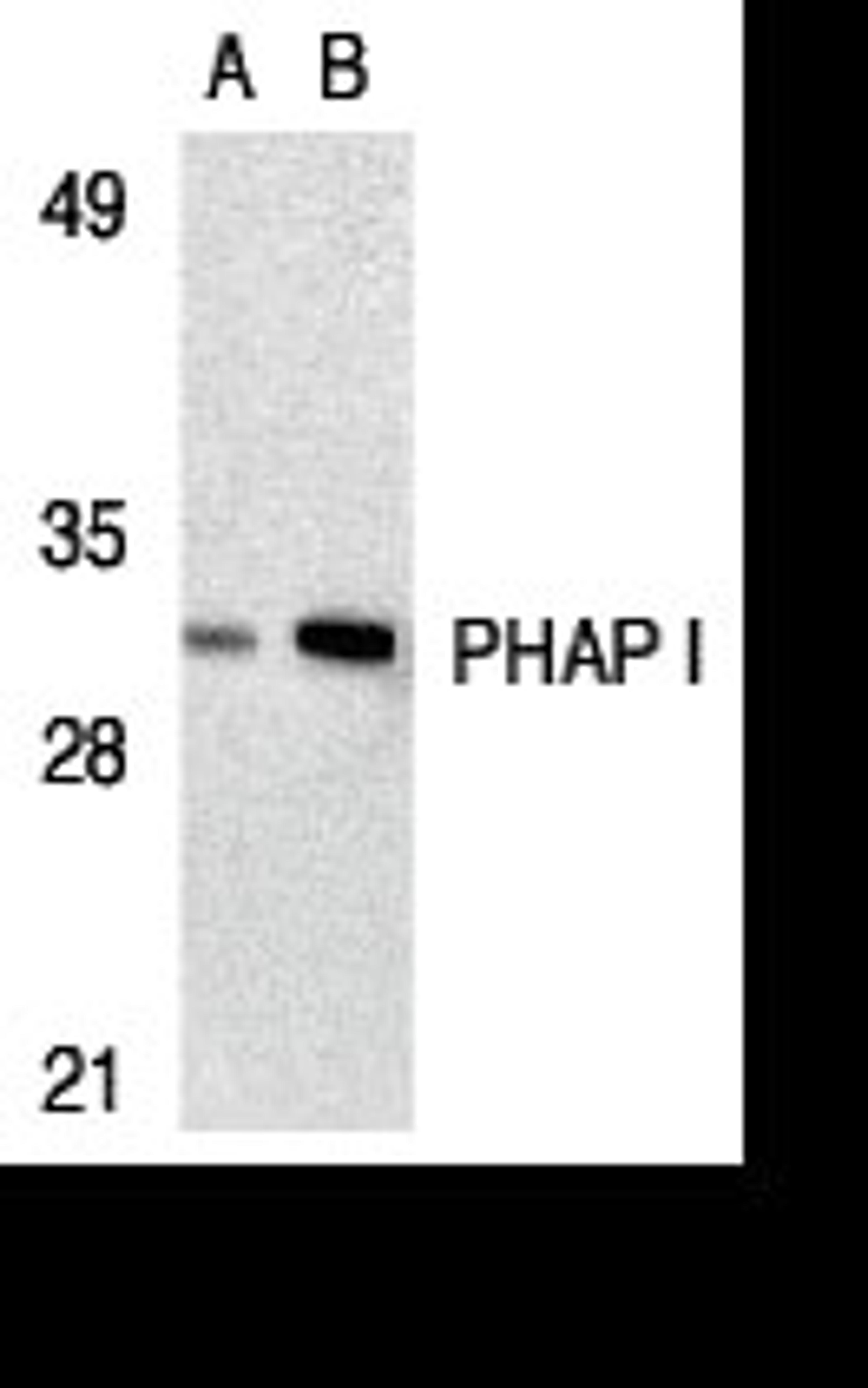 Western blot analysis of PHAP I expression in human Raji cell lysate with PHAP antibody I at 2 μg/mL (lane A) and 4 μg/mL (lane B), respectively.