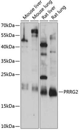 Western blot - PRRG2 antibody (A14380)