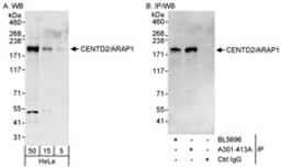 Detection of human CENTD2/ARAP1 by western blot and immunoprecipitation.