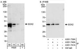 Detection of human SOX2 by western blot and immunoprecipitation.