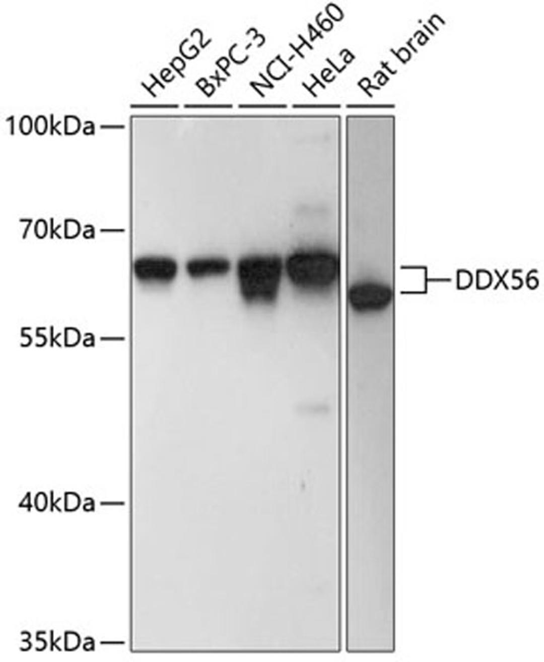 Western blot - DDX56 antibody (A9487)