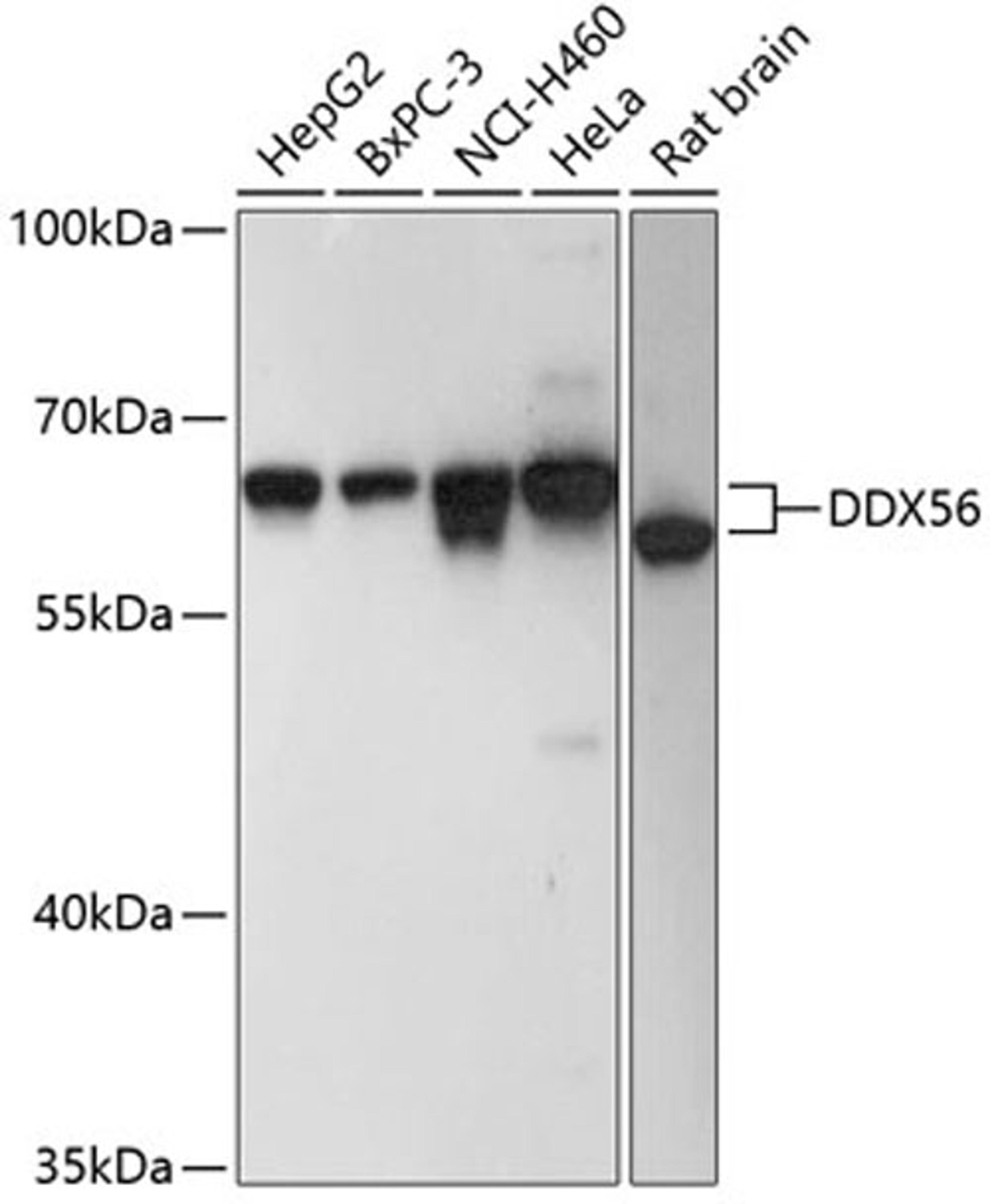 Western blot - DDX56 antibody (A9487)