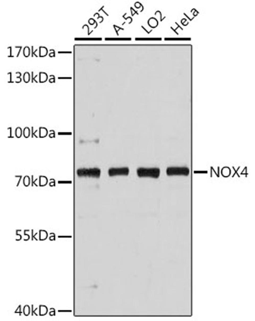 Western blot - NOX4 antibody (A11274)