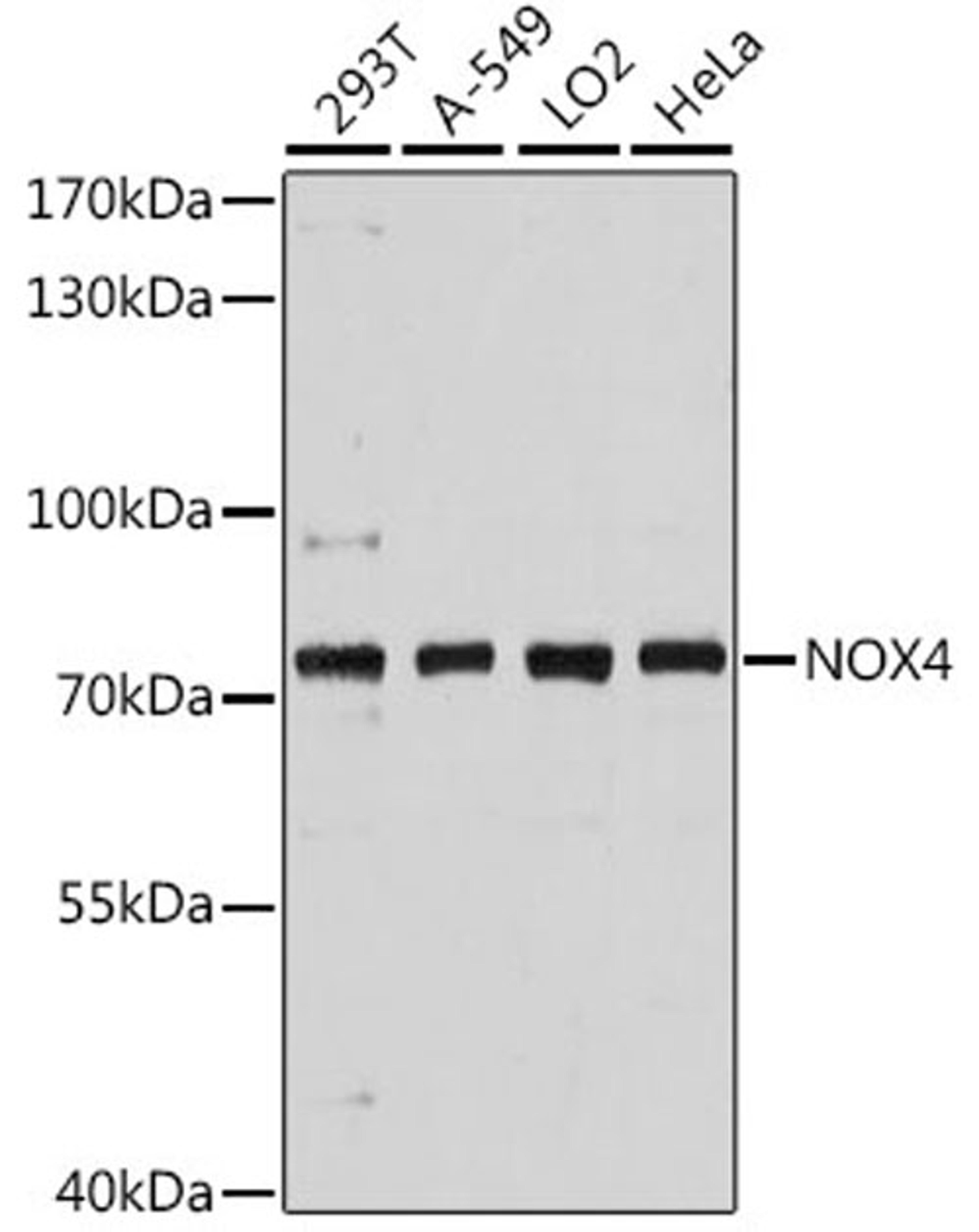 Western blot - NOX4 antibody (A11274)